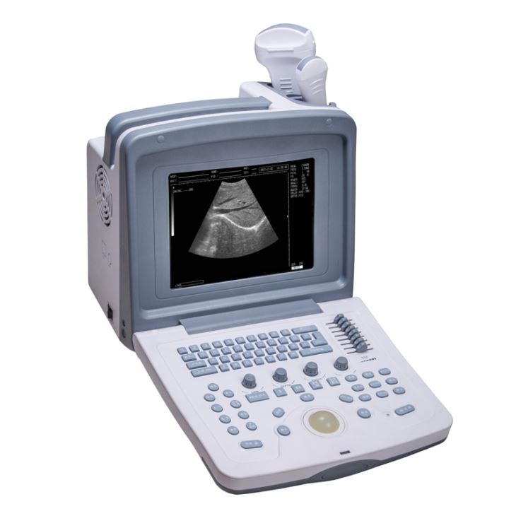 Full Digital Ultrasonic Diagnostic System