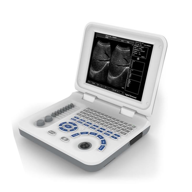 LED Laptop Ultrasound Scanner