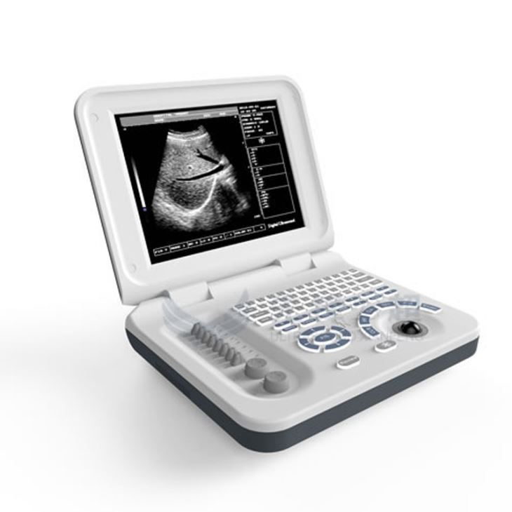 LED Laptop Ultrasound Scanner