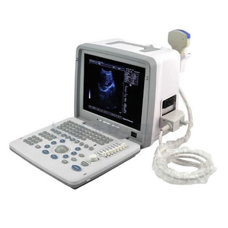 Portable Black And White Ultrasound Scanner