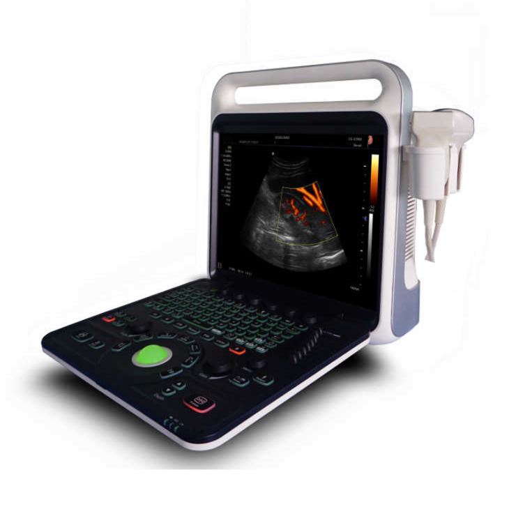 Portable Ultrasound Color Doppler Diagnostic Scanner