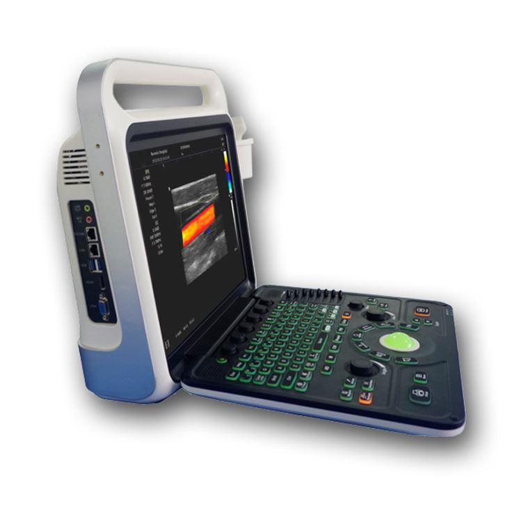 Portable Ultrasound Color Doppler Diagnostic Scanner